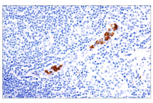 Immunohistochemistry Image 3: CD235a/Glycophorin A (JC159) Rabbit mAb