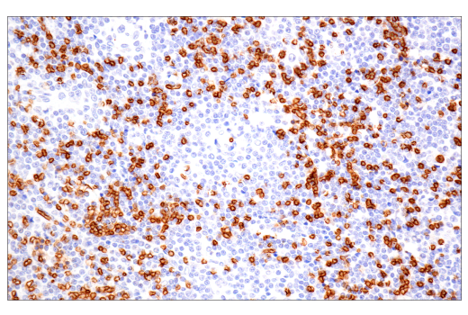Immunohistochemistry Image 1: CD235a/Glycophorin A (JC159) Rabbit mAb
