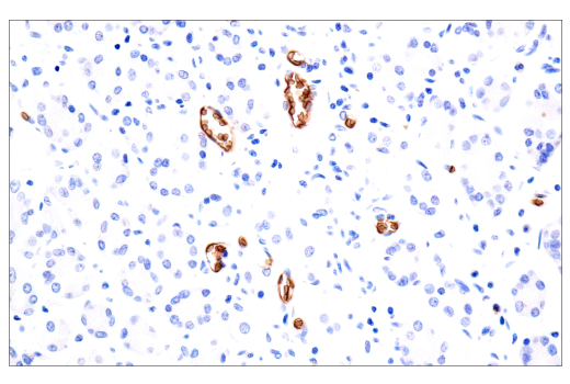 Immunohistochemistry Image 5: CD235a/Glycophorin A (JC159) Rabbit mAb