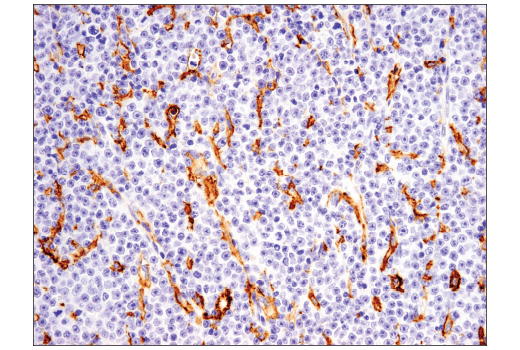 Immunohistochemistry Image 1: CD14 (D7A2T) Rabbit mAb (IHC Formulated)