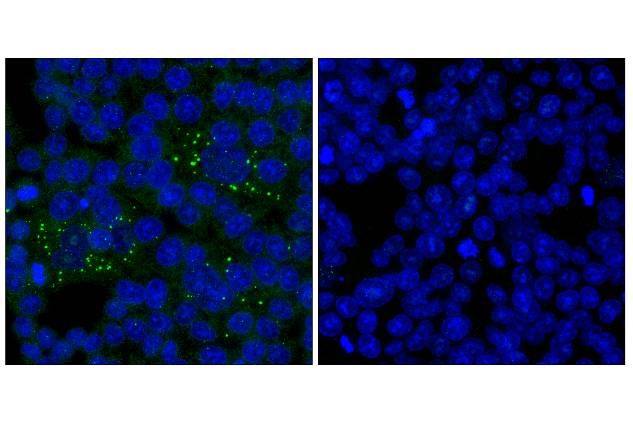 Immunofluorescence Image 1: WIPI2 (2A2) Mouse Monoclonal Antibody