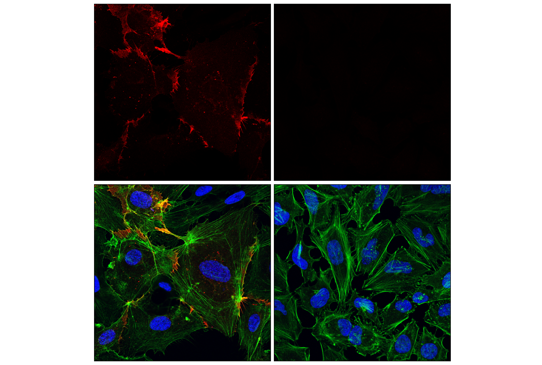 Immunofluorescence Image 1: CD31 (PECAM-1) (89C2) Mouse mAb (Alexa Fluor® 594 Conjugate)