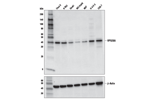 Western Blotting Image 1: VPS26A Antibody