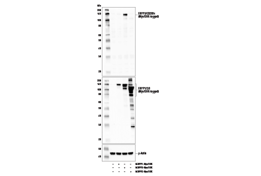 Western Blotting Image 1: ENPP3/CD203c Antibody