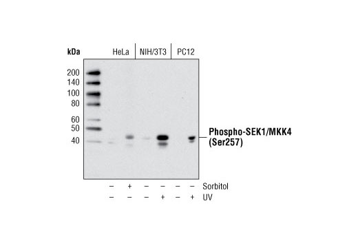 Western Blotting Image 1: Phospho-SEK1/MKK4 (Ser257) (C36C11) Rabbit mAb (BSA and Azide Free)