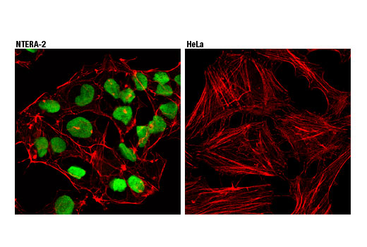 Immunofluorescence Image 1: Oct-4 (D7O5Z) Mouse mAb