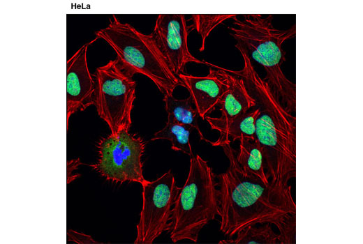 Immunofluorescence Image 1: DDX5 (D15E10) XP® Rabbit mAb (BSA and Azide Free)