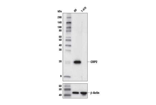 Western Blotting Image 1: CRP2 Antibody