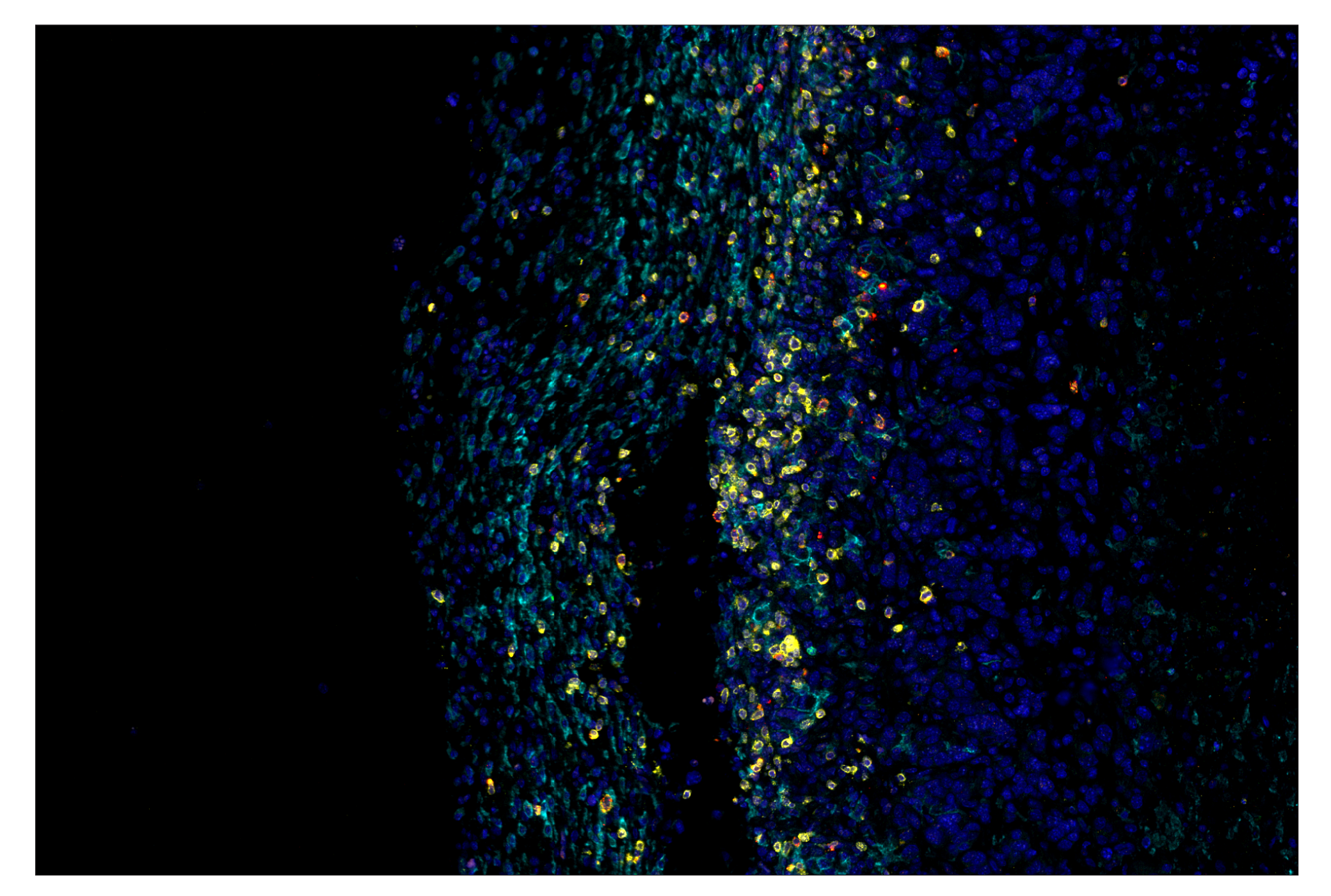Immunohistochemistry Image 7: Ly-6G (E6Z1T) & CO-0053-647 SignalStar™ Oligo-Antibody Pair