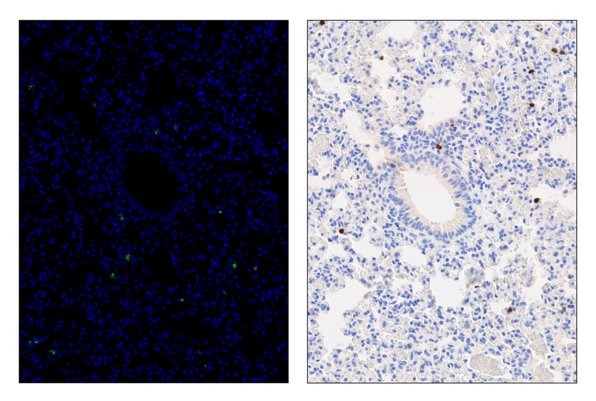 Immunohistochemistry Image 6: Ly-6G (E6Z1T) & CO-0053-750 SignalStar™ Oligo-Antibody Pair