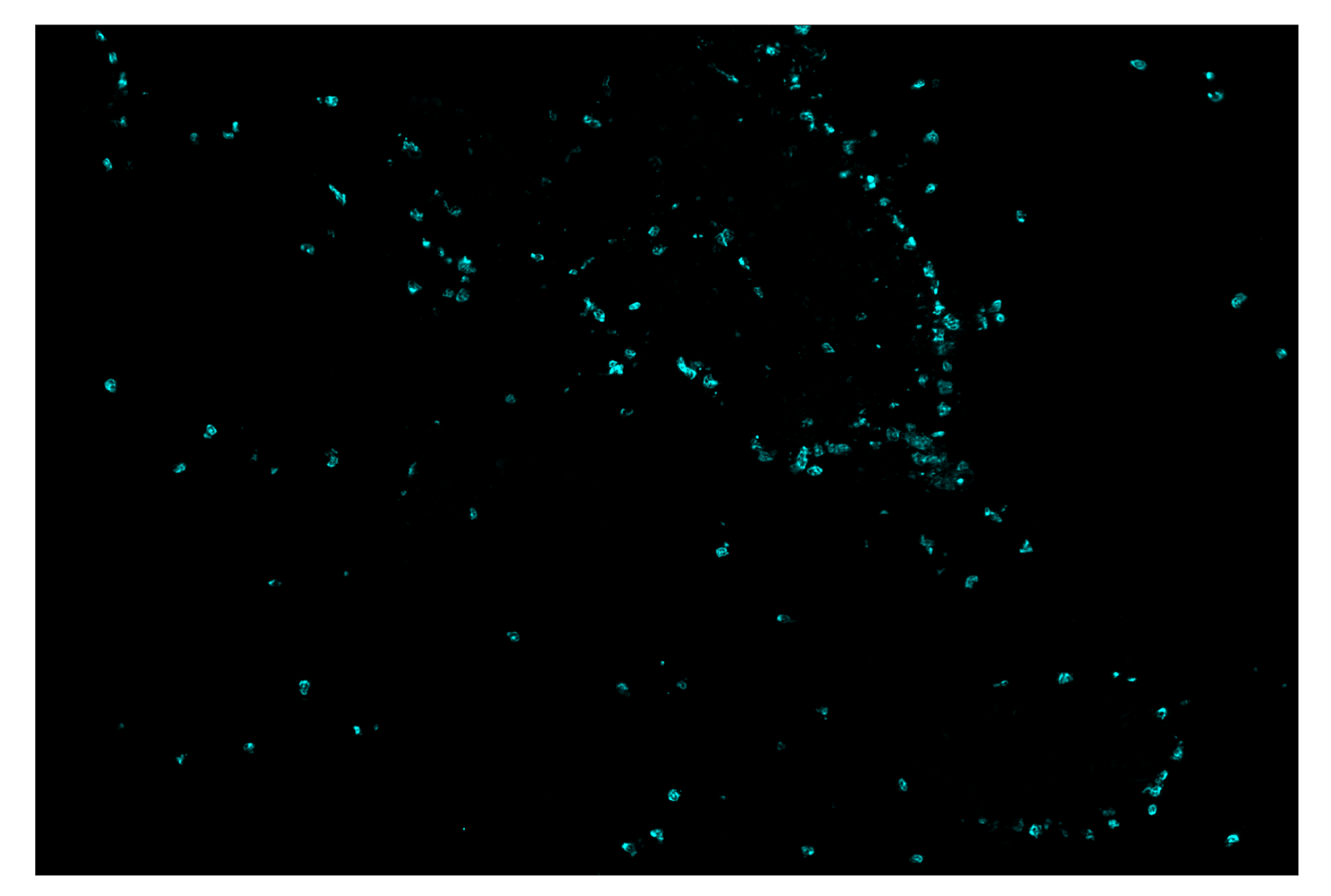Immunohistochemistry Image 5: Ly-6G (E6Z1T) & CO-0053-488 SignalStar™ Oligo-Antibody Pair