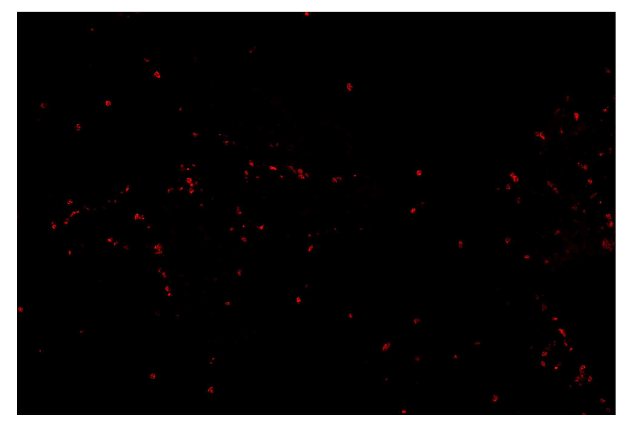 Immunohistochemistry Image 4: Ly-6G (E6Z1T) & CO-0053-750 SignalStar™ Oligo-Antibody Pair