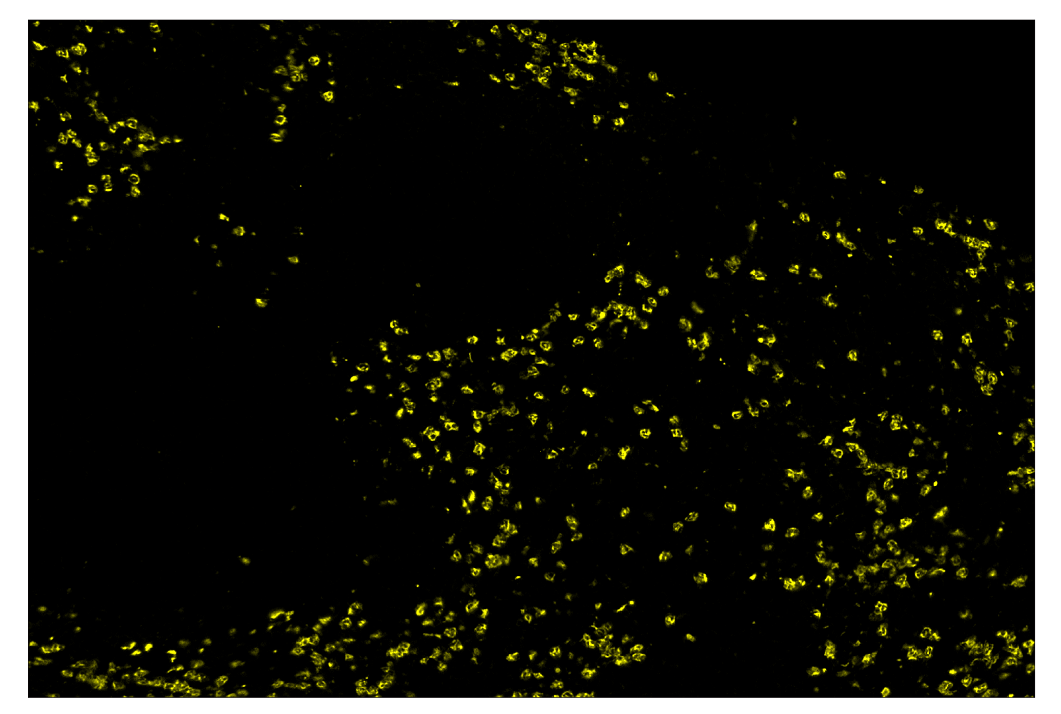 Immunohistochemistry Image 3: Ly-6G (E6Z1T) & CO-0053-488 SignalStar™ Oligo-Antibody Pair