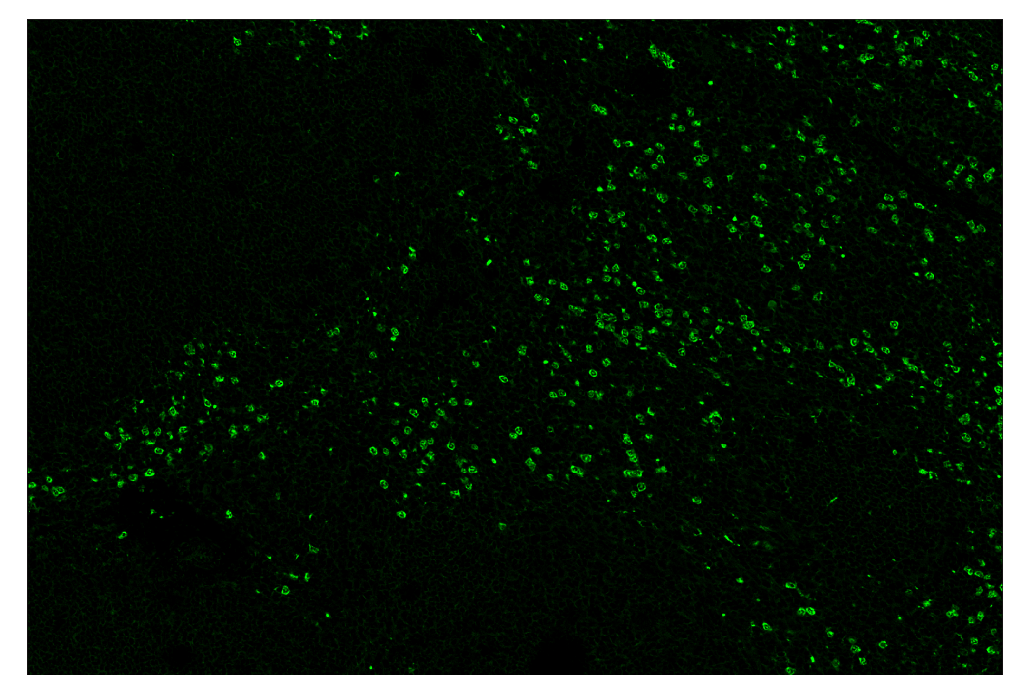 Immunohistochemistry Image 2: Ly-6G (E6Z1T) & CO-0053-594 SignalStar™ Oligo-Antibody Pair