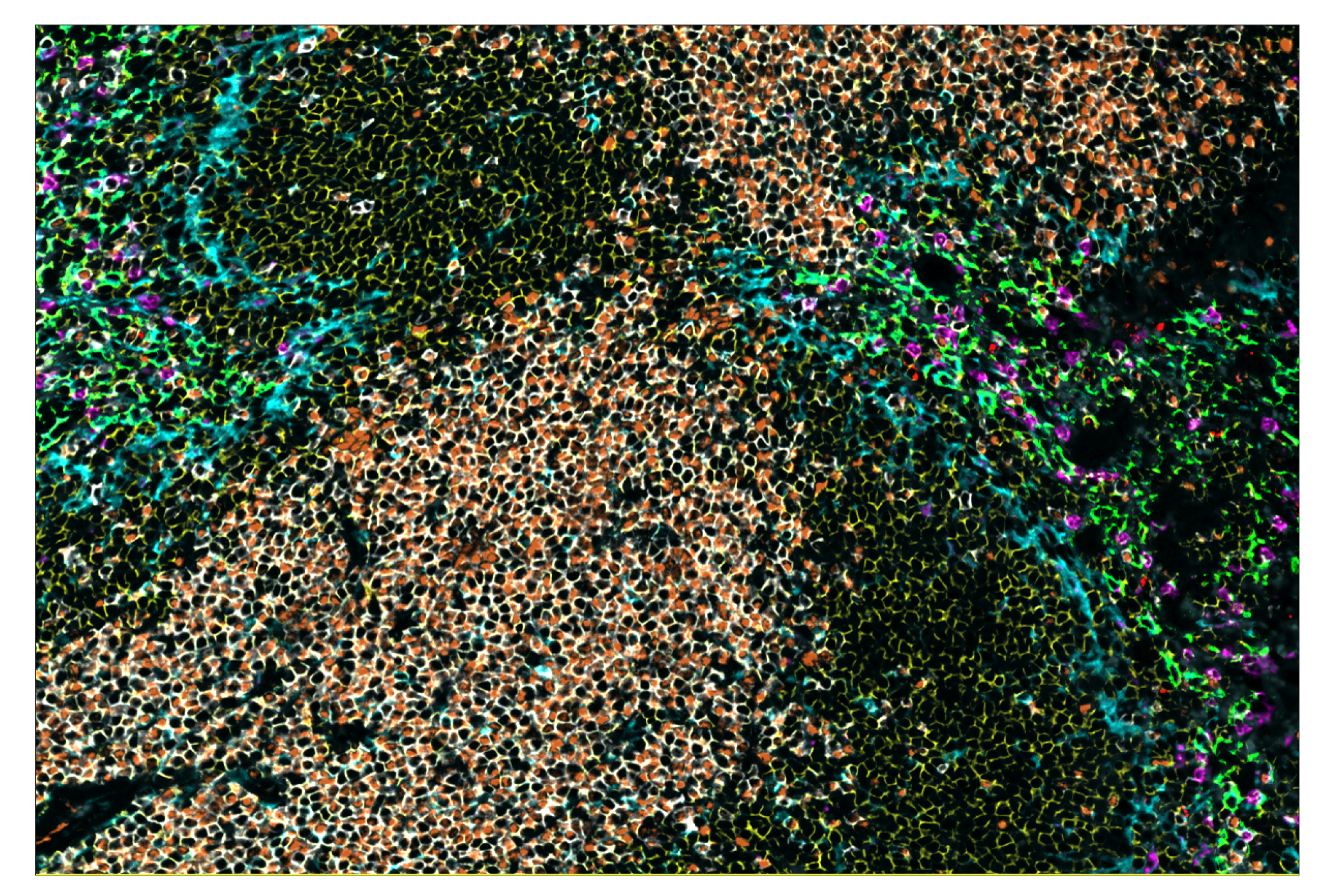 Immunohistochemistry Image 1: Ly-6G (E6Z1T) & CO-0053-594 SignalStar™ Oligo-Antibody Pair