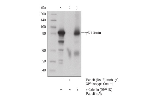 Immunoprecipitation Image 1: γ-Catenin (D9M1Q) Rabbit mAb