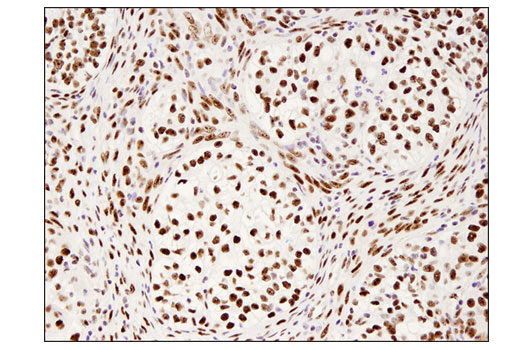 Immunohistochemistry Image 3: PELP1 (D5Q4W) Rabbit mAb (BSA and Azide Free)