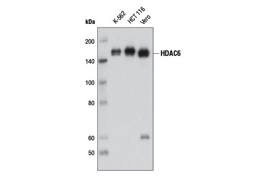  Image 8: Histone Deacetylase (HDAC) Antibody Sampler Kit