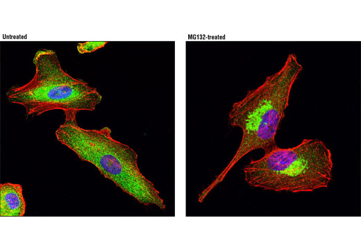 Immunofluorescence Image 1: HDAC6 (D2E5) Rabbit mAb