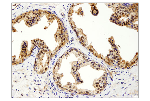 Immunohistochemistry Image 5: Akt1 (D9R8K) Rabbit mAb