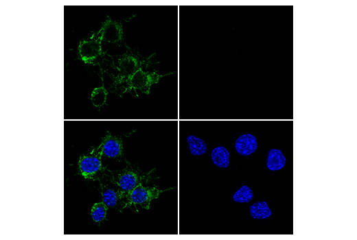 Immunofluorescence Image 2: TIM-3 (E9K5D) Rabbit mAb