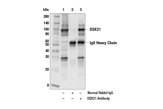 Immunoprecipitation Image 1: DDX21 Antibody