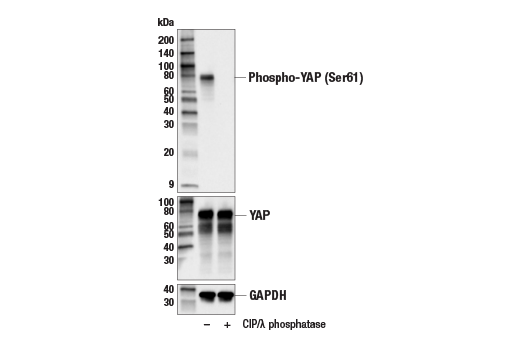 Western Blotting Image 1: Phospho-YAP (Ser61) Antibody