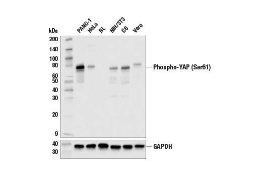 Western Blotting Image 3: Phospho-YAP (Ser61) Antibody
