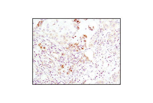 Immunohistochemistry Image 1: Hexokinase I (C35C4) Rabbit mAb (BSA and Azide Free)