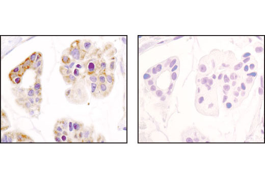 Immunohistochemistry Image 2: Hexokinase I (C35C4) Rabbit mAb (BSA and Azide Free)