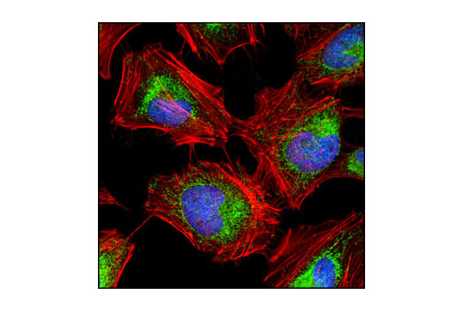 Immunofluorescence Image 1: Hexokinase I (C35C4) Rabbit mAb (BSA and Azide Free)