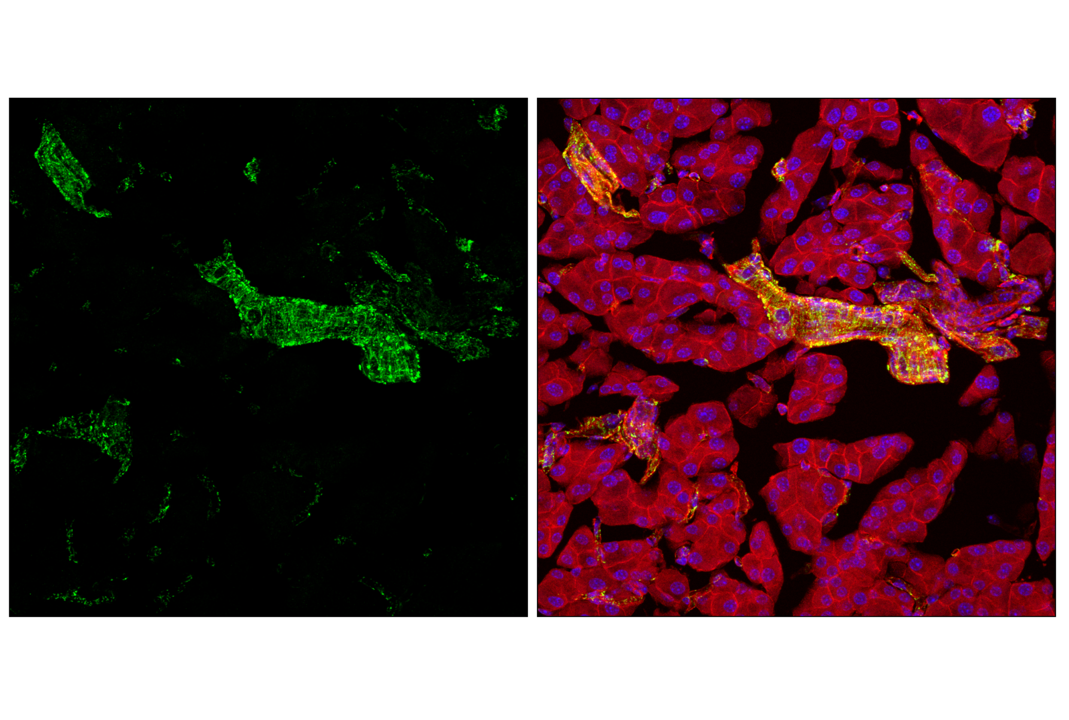 Immunofluorescence Image 2: Hexokinase I (C35C4) Rabbit mAb (BSA and Azide Free)