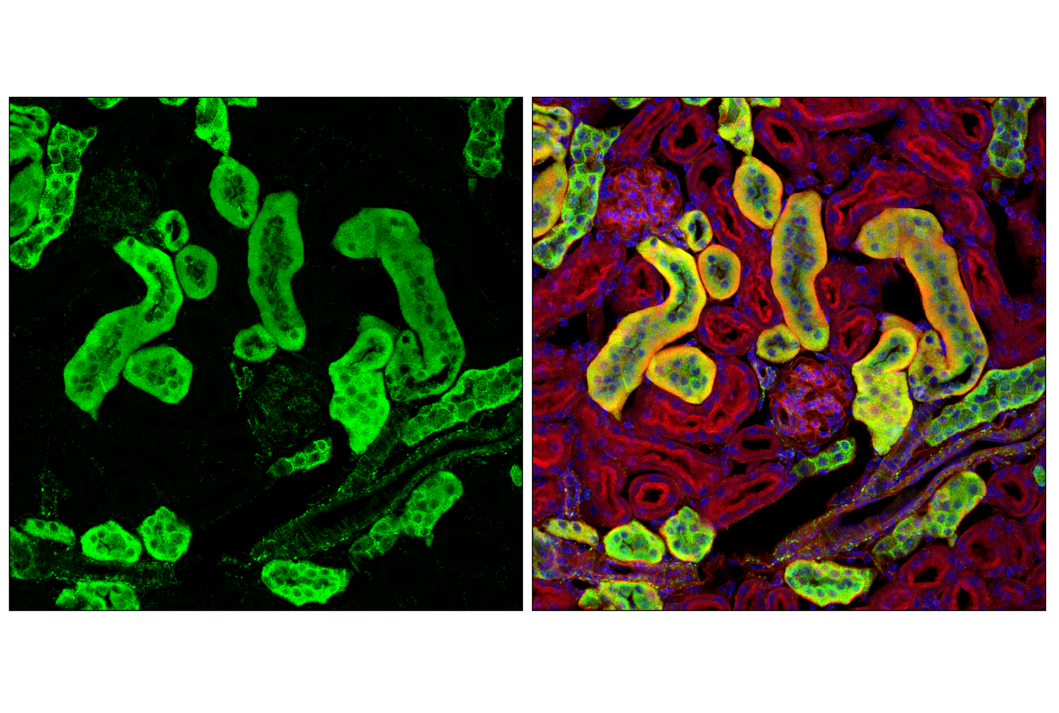 Immunofluorescence Image 3: Hexokinase I (C35C4) Rabbit mAb (BSA and Azide Free)