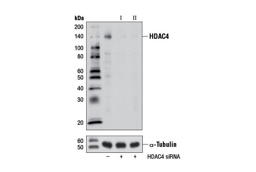  Image 1: SignalSilence® HDAC4 siRNA I