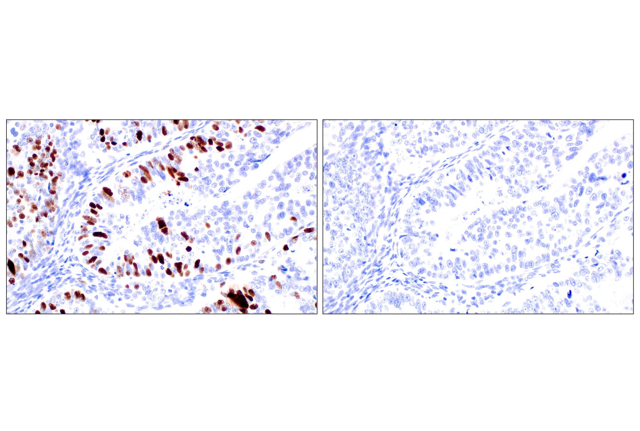 Immunohistochemistry Image 16: Phospho-NPM1 (Thr199) (E4C7S) Rabbit mAb