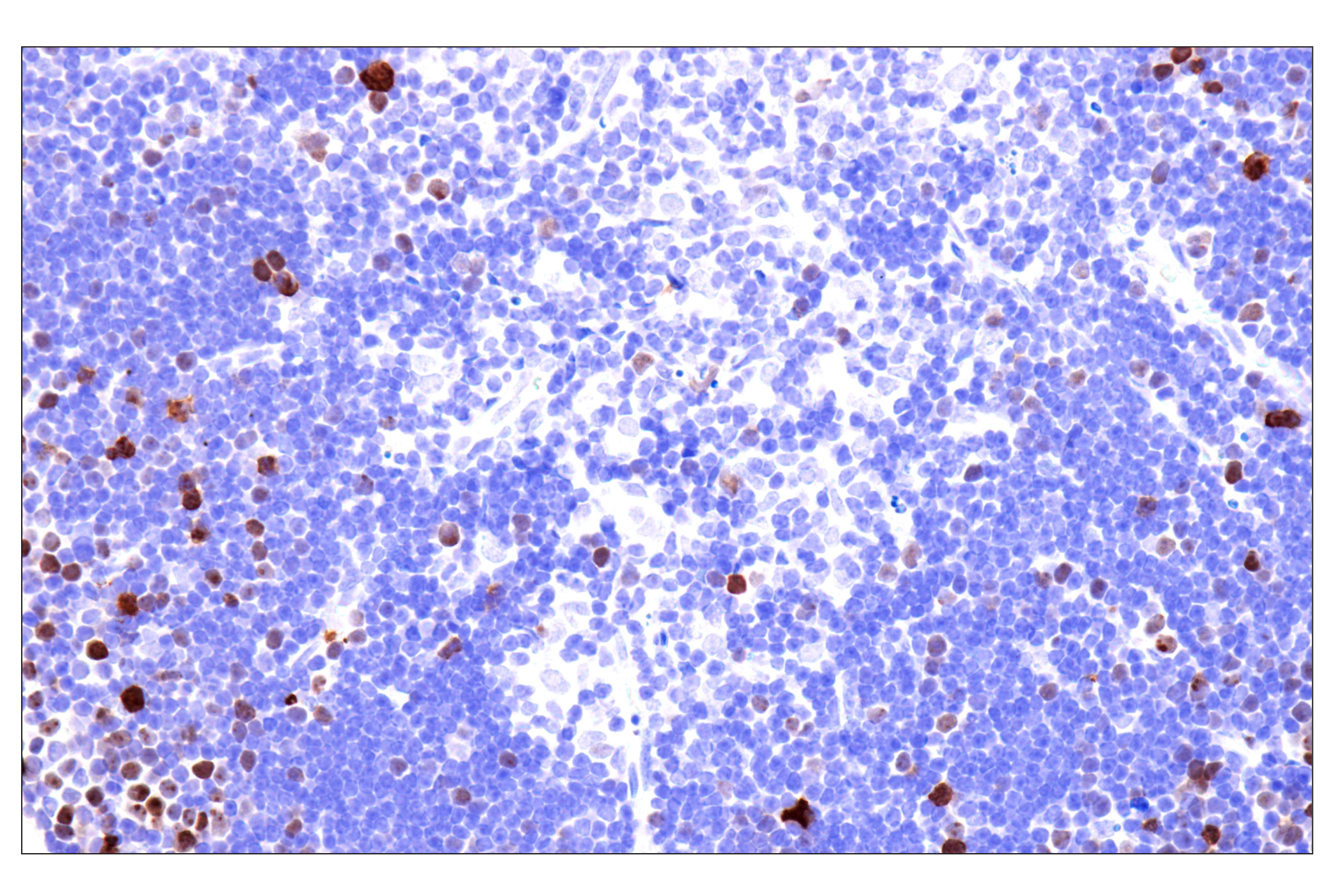 Immunohistochemistry Image 13: Phospho-NPM1 (Thr199) (E4C7S) Rabbit mAb