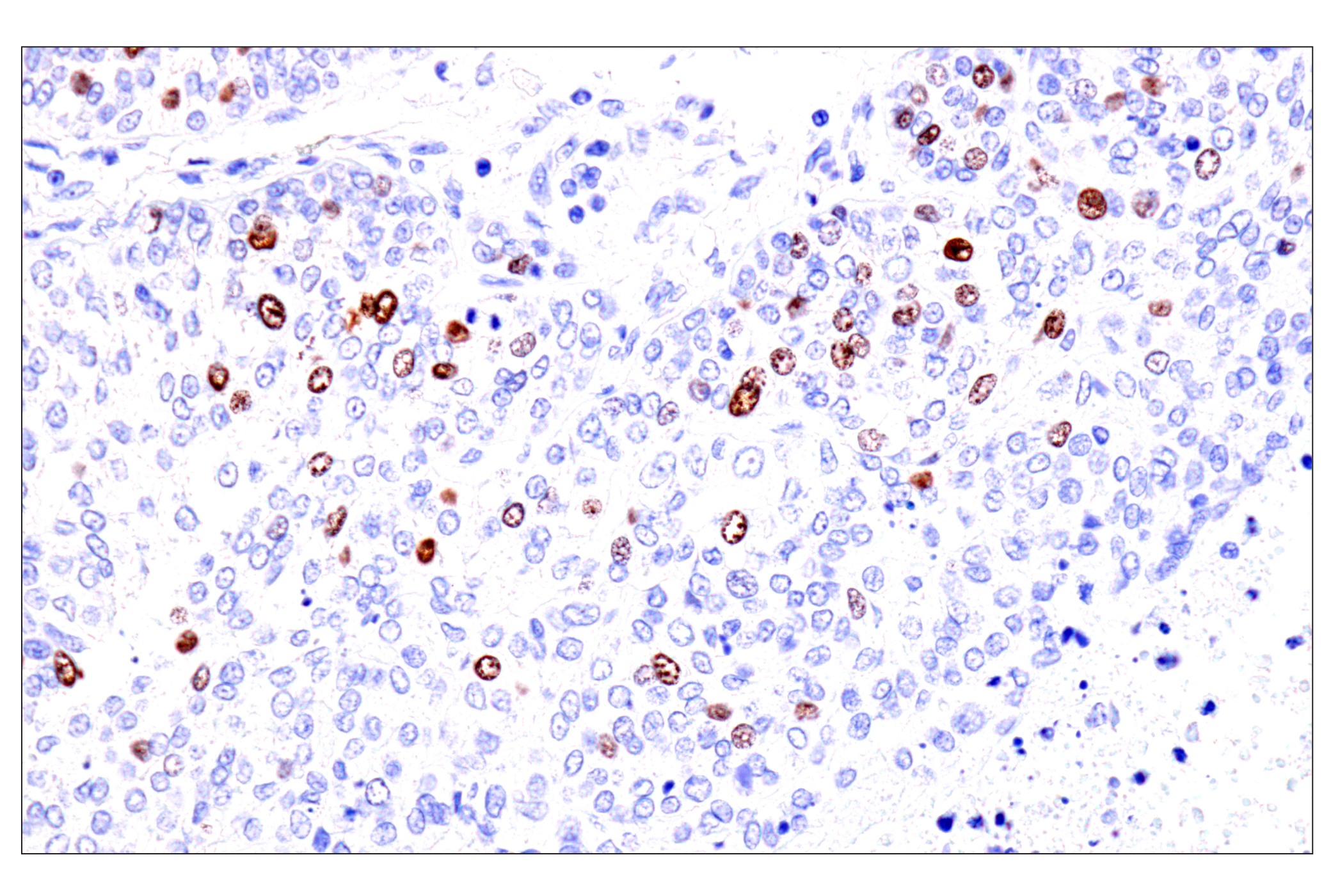 Immunohistochemistry Image 5: Phospho-NPM1 (Thr199) (E4C7S) Rabbit mAb