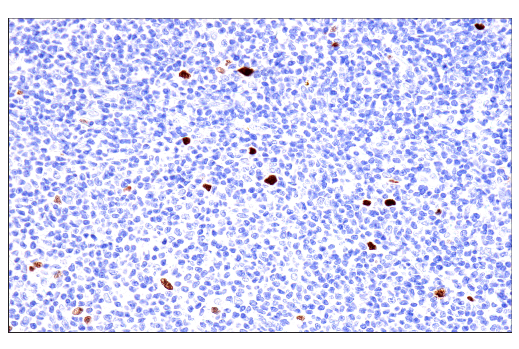 Immunohistochemistry Image 4: Phospho-NPM1 (Thr199) (E4C7S) Rabbit mAb