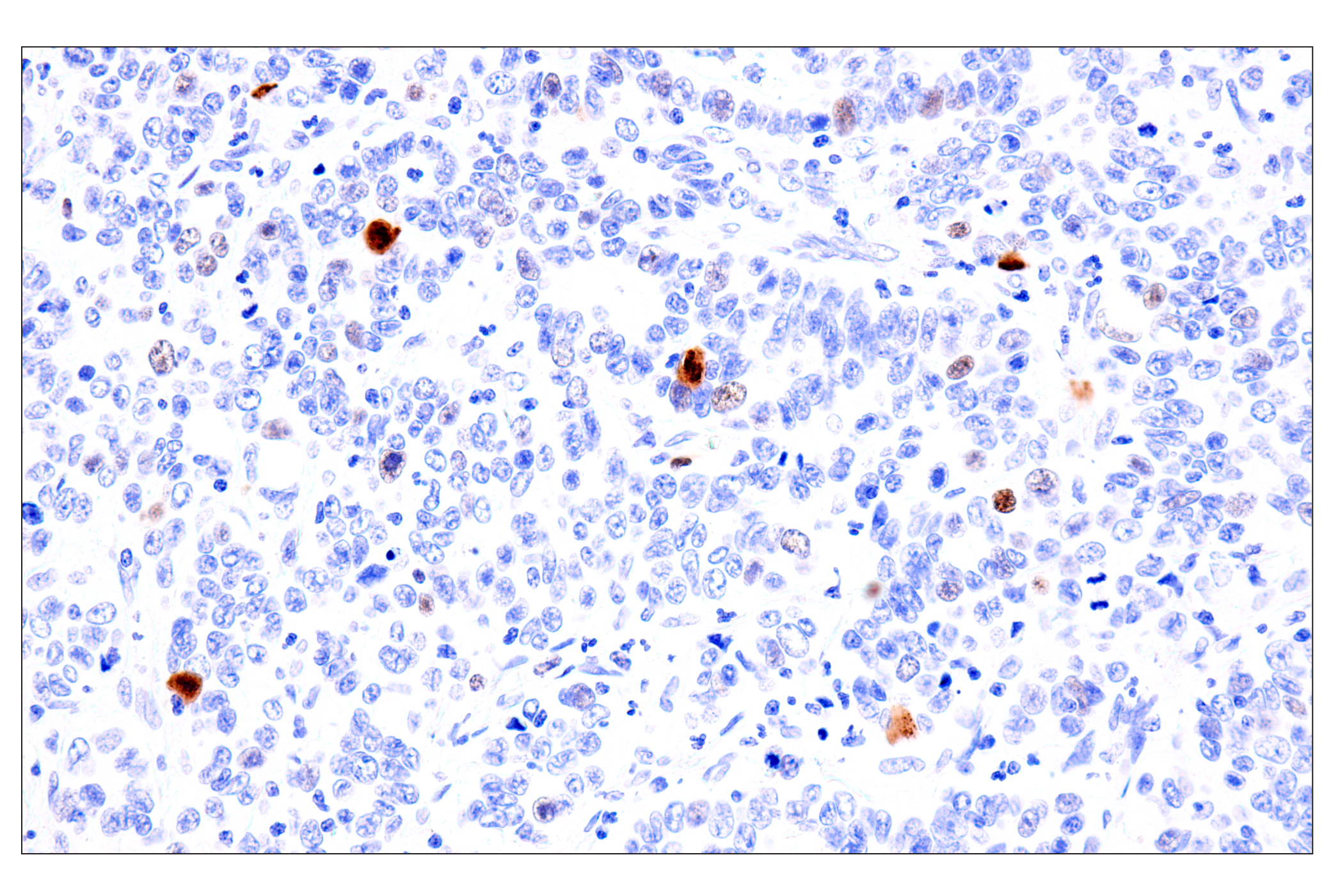 Immunohistochemistry Image 3: Phospho-NPM1 (Thr199) (E4C7S) Rabbit mAb