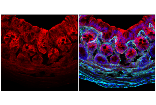 Immunofluorescence Image 1: Galectin-3/LGALS3 (E7B6R) Rabbit mAb (BSA and Azide Free)