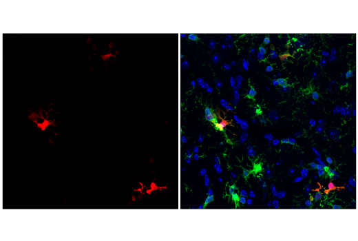 Immunofluorescence Image 2: Galectin-3/LGALS3 (E7B6R) Rabbit mAb (BSA and Azide Free)