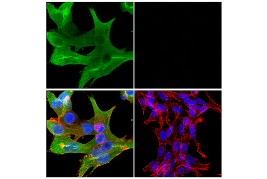 Immunofluorescence Image 3: Galectin-3/LGALS3 (E7B6R) Rabbit mAb (BSA and Azide Free)