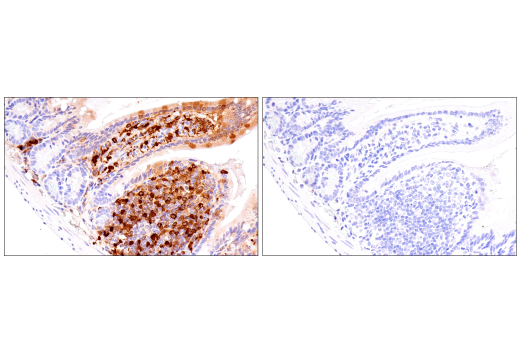 Immunohistochemistry Image 13: Galectin-3/LGALS3 (E7B6R) Rabbit mAb (BSA and Azide Free)