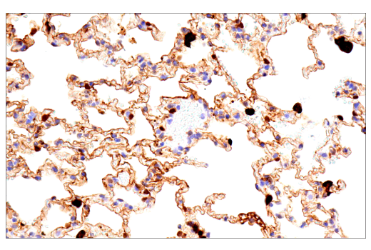 Immunohistochemistry Image 8: Galectin-3/LGALS3 (E7B6R) Rabbit mAb (BSA and Azide Free)
