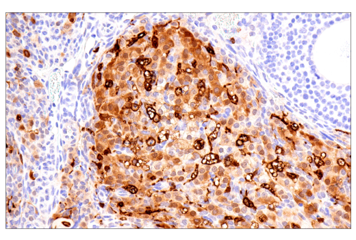 Immunohistochemistry Image 9: Galectin-3/LGALS3 (E7B6R) Rabbit mAb (BSA and Azide Free)