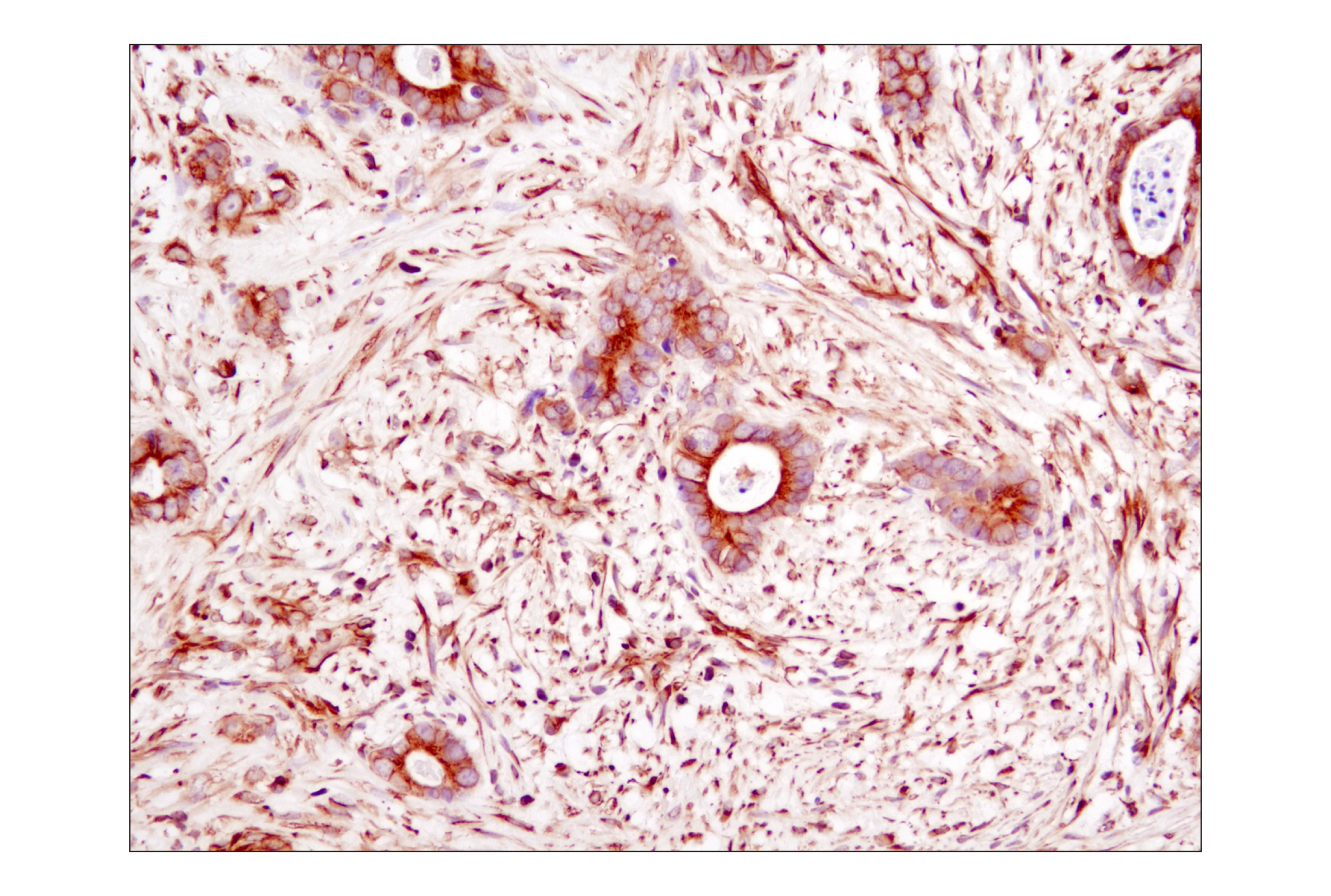 Immunohistochemistry Image 1: α-Tubulin (DM1A) Mouse mAb (BSA and Azide Free)