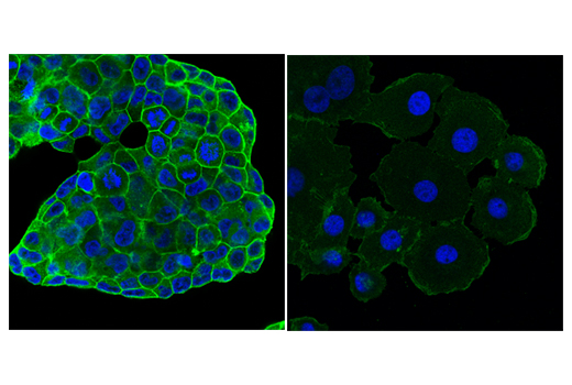 Immunofluorescence Image 3: Ras (E4K9L) Rabbit mAb (BSA and Azide Free)