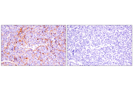 Immunohistochemistry Image 4: CD21/CR2 (2G9) Mouse mAb