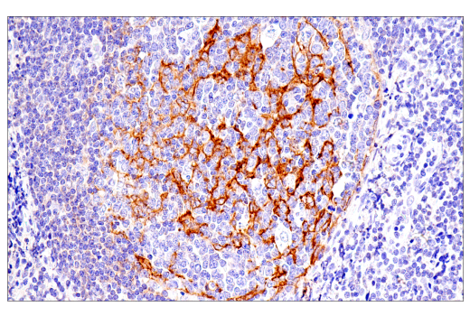 Immunohistochemistry Image 2: CD21/CR2 (2G9) Mouse mAb
