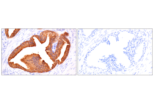 Immunohistochemistry Image 7: TIMP1 (D10E6) Rabbit mAb (BSA and Azide Free)